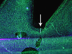 NDT- Non-Destructive Testing